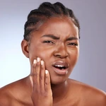 Oily Acne Prone Skin logo